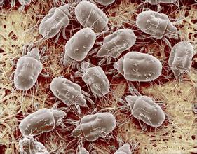 家居防螨除螨全攻略